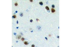 Immunohistochemical analysis of ZC3H7B staining in human brain formalin fixed paraffin embedded tissue section. (ZC3H7B antibody  (C-Term))