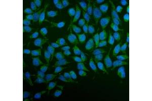 IF analysis of PFKFB2 using anti-PFKFB2 antibody (ABIN7601627).