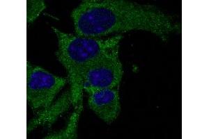 Immunofluorescence - anti-PS3 Ab in Hepa1-6 cells at 1/50 dilution, cells were fixed with methanol, (p53 antibody  (C-Term))