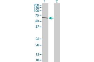 Western Blot analysis of DYRK2 expression in transfected 293T cell line by DYRK2 monoclonal antibody (M02), clone 6E2. (DYRK2 antibody  (AA 1-100))