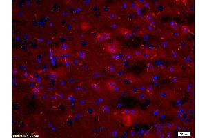 Formalin-fixed and paraffin embedded: rat brain tissue labeled with Anti-ARC Polyclonal Antibody (ABIN739460), Unconjugated at 1:200, followed by conjugation to the secondary antibody was Goat Anti-Rabbit IgG, PE conjugated at 1:200 for 40 minutes at 37°C DAPI(5 µg/ml, blue) was used to stain the cell nuclei (Arc antibody  (AA 101-200))