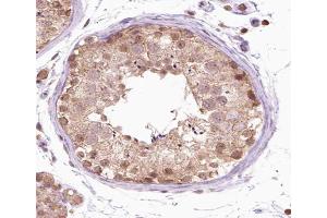 ABIN6266538 at 1/100 staining human testis tissue sections by IHC-P.