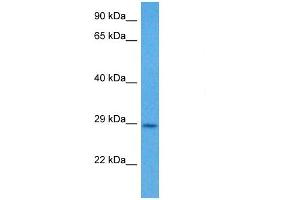 Western Blotting (WB) image for anti-Casein Kinase 2, beta (CSNK2B) (N-Term) antibody (ABIN2783252)