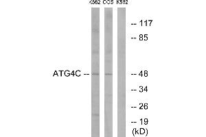 Immunohistochemistry analysis of paraffin-embedded human liver carcinoma tissue using ATG4C antibody. (ATG4C antibody  (Internal Region))