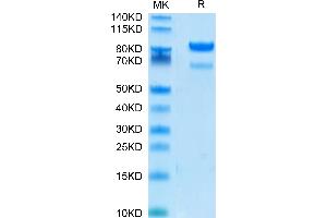 Human ROR2 on Tris-Bis PAGE under reduced conditions. (ROR2 Protein (AA 34-403) (Fc Tag))