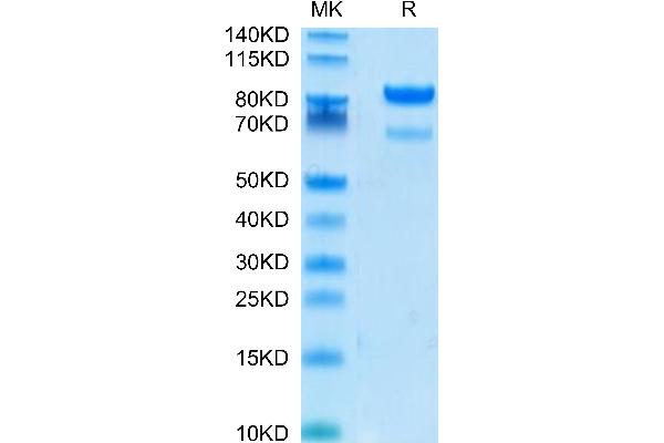 ROR2 Protein (AA 34-403) (Fc Tag)