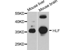 Western blot analysis of extract of mouse liver and mouse brain cells, using HLF antibody. (HLF antibody)