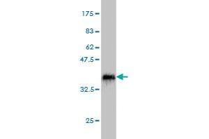 Western Blot detection against Immunogen (36. (CALCOCO2 antibody  (AA 347-446))
