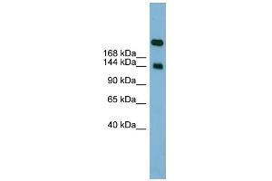 WB Suggested Anti-SI Antibody Titration:  0.