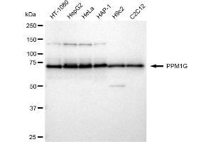 anti-Protein Phosphatase, Mg2+/Mn2+ Dependent, 1G (PPM1G) antibody