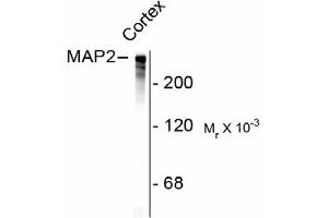 Image no. 1 for anti-Microtubule-Associated Protein 2 (MAP2) antibody (ABIN303924) (MAP2 antibody)