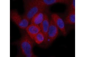 IF analysis of Hamartin/TSC1 using anti-Hamartin/TSC1 antibody (ABIN7599499). (TSC1 antibody  (AA 1-618))