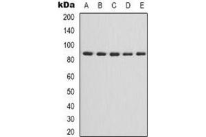 Western blot analysis of IKK alpha/beta expression in HepG2 (A), HEK293T (B), NIH3T3 (C), mouse brain (D), rat heart (E) whole cell lysates. (IKK-alpha /IKK-beta antibody)