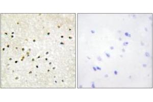 Immunohistochemistry (IHC) image for anti-General Transcription Factor IIH, Polypeptide 1, 62kDa (GTF2H1) (AA 15-64) antibody (ABIN2889452)