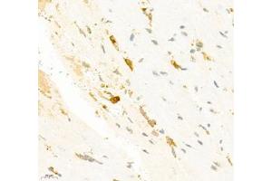 Immunohistochemistry of paraffin embedded mouse heart using SMYD2 (ABIN7075581) at dilution of 1:2000 (400x lens)