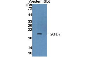 Western blot analysis of the recombinant protein. (IL17B antibody  (AA 21-180))