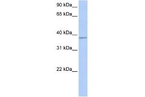 WB Suggested Anti-FGFR1OP Antibody Titration: 0. (FGFR1OP antibody  (Middle Region))