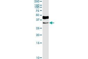 Immunoprecipitation of HOXD8 transfected lysate using anti-HOXD8 MaxPab rabbit polyclonal antibody and Protein A Magnetic Bead , and immunoblotted with HOXD8 MaxPab rabbit polyclonal antibody (D01) . (HOXD8 antibody  (AA 1-289))