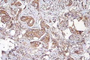 IHC analysis of APPL1 using anti-APPL1 antibody (ABIN7602658).