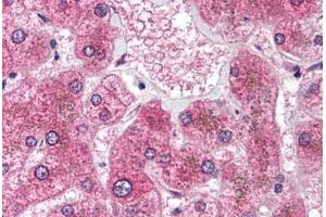 Human Liver (formalin-fixed, paraffin-embedded) stained with HSD11B1 antibody ABIN214180 at 5 ug/ml followed by biotinylated goat anti-rabbit IgG secondary antibody ABIN481713, alkaline phosphatase-streptavidin and chromogen. (HSD11B1 antibody  (AA 77-92))