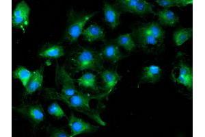 Anti-TUBAL3 mouse monoclonal antibody (ABIN2455275) immunofluorescent staining of COS7 cells transiently transfected by pCMV6-ENTRY TUBAL3 (RC216194). (TUBAL3 antibody  (AA 150-446))