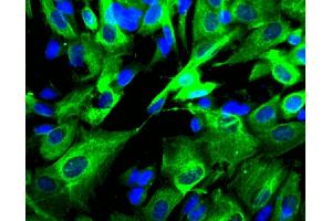 Immunofluorescent staining of SK-N-SH cells (Human neuroblastoma, ATCC HTB-11) (right). (AP2B1 antibody  (AA 75-245))
