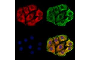 ABIN7094477 and ABIN7098525 staining Hela cells by IF/ICC. (DYNC1I1 antibody  (Internal Region))