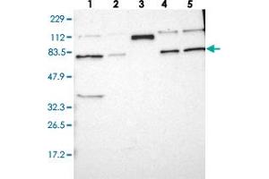 Western blot analysis of Lane 1: RT-4, Lane 2: U-251 MG, Lane 3: Human Plasma, Lane 4: Liver, Lane 5: Tonsil with HRC polyclonal antibody .