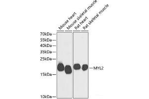 Western blot analysis of extracts of various cell lines using MYL2 Polyclonal Antibody at dilution of 1:500. (MYL2 antibody)