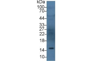 Detection of ANG in Human Serum using Polyclonal Antibody to Angiogenin (ANG) (ANG antibody  (AA 25-147))