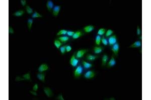Immunofluorescence staining of Hela cells with ABIN7146901 at 1:40, counter-stained with DAPI. (FLIP antibody  (AA 1-250))