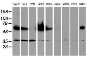Image no. 2 for anti-Epsin 2 (EPN2) antibody (ABIN1498049) (Epsin 2 antibody)