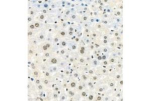 Immunohistochemistry of paraffin embedded mouse liver using HIF-3α (ABIN7074273) at dilution of 1:1600 (400x lens) (HIF3A antibody)