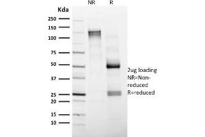 SDS-PAGE Analysis Purified CD4 Mouse Monoclonal Antibody (CD4/1604). (CD4 antibody  (AA 245-392))
