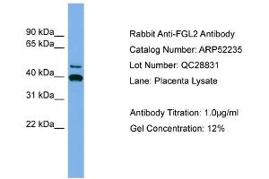WB Suggested Anti-FGL2  Antibody Titration: 0. (FGL2 antibody  (Middle Region))