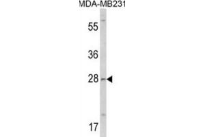 Western Blotting (WB) image for anti-Collectin Sub-Family Member 11 (COLEC11) antibody (ABIN3002827) (COLEC11 antibody)