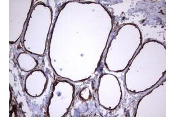 TNFRSF8 antibody  (AA 19-379)