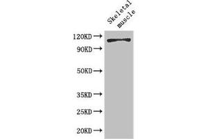 Western Blot Positive WB detected in: Mouse skeletal muscle tissue All lanes: EPHB6 antibody at 2 μg/mL Secondary Goat polyclonal to rabbit IgG at 1/50000 dilution Predicted band size: 111, 82, 58 kDa Observed band size: 111 kDa (EPH Receptor B6 antibody  (AA 410-553))