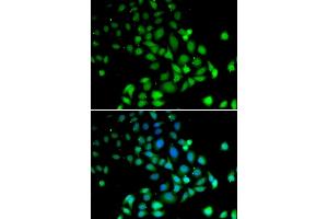 Immunofluorescence analysis of U2OS cells using PARN antibody (ABIN1681249, ABIN3018397, ABIN3018398 and ABIN6220460). (PARN antibody  (AA 1-280))