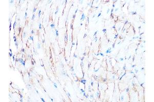 Immunohistochemistry of paraffin-embedded mouse heart using Dystrophin Rabbit mAb (ABIN7266871) at dilution of 1:100 (40x lens). (Dystrophin antibody)