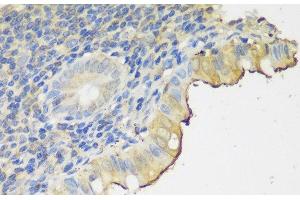 Immunohistochemistry of paraffin-embedded Human appendix using CLN5 Polyclonal Antibody at dilution of 1:150 (40x lens).