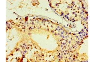 Immunohistochemistry of paraffin-embedded human testis tissue using ABIN7143026 at dilution of 1:100 (ACRV1 antibody  (AA 22-265))
