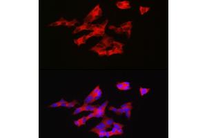 Immunofluorescence analysis of SH-SY5Y cells using GNRH1 Rabbit pAb (ABIN6131875, ABIN6141257, ABIN6141258 and ABIN6221260) at dilution of 1:200 (40x lens). (GNRH1 antibody  (AA 24-92))
