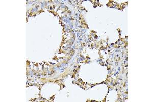 Immunohistochemistry of paraffin-embedded rat lung using PSMB3 antibody (ABIN6131929, ABIN6146317, ABIN6146318 and ABIN6225280) at dilution of 1:100 (40x lens). (PSMB3 antibody  (AA 1-205))