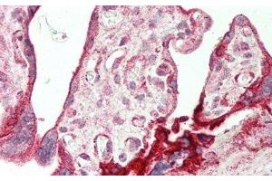 Detection of AREG in Human Placenta Tissue using Polyclonal Antibody to Amphiregulin (AREG) (Amphiregulin antibody  (AA 20-100))