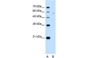 PIGV antibody used at 1 ug/ml to detect target protein. (PIGV antibody  (N-Term))