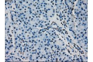 Immunohistochemical staining of paraffin-embedded pancreas tissue using anti-CRYABmouse monoclonal antibody. (CRYAB antibody)