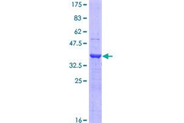 LOXL4 Protein (AA 657-755) (GST tag)