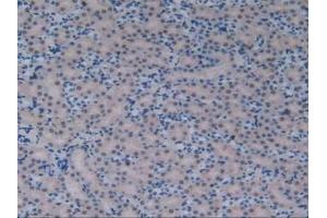 Immunohistochemistry (IHC) image for anti-Activating Transcription Factor 1 (AFT1) (AA 3-245) antibody (ABIN7444082)