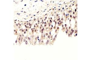 Immunohistochemical analysis of paraffin-embedded H. (Pan SUMO antibody)